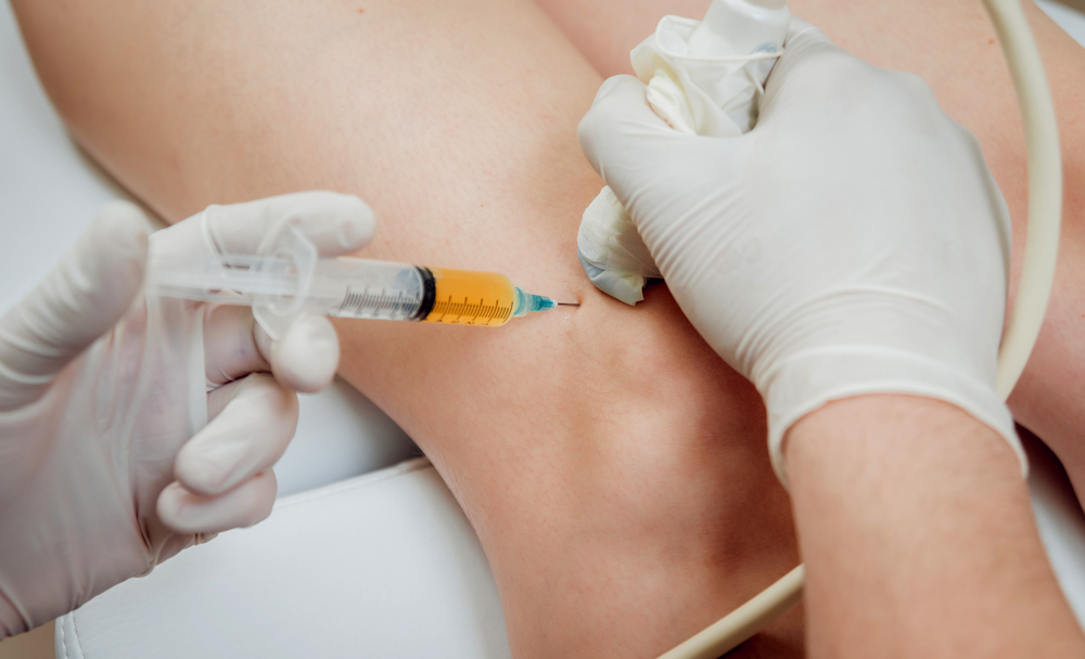 Ultrasound guided,Platelet rich,Plasma,Injection,Of,The,Knee