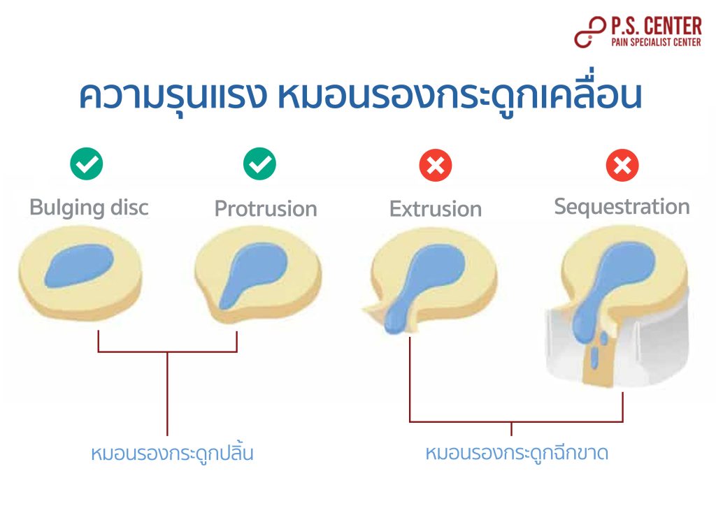 Untitled (ไทย)