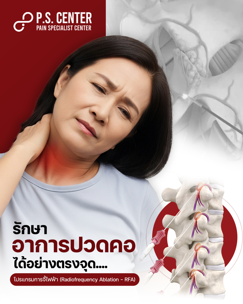 รีวิวอาการปวดคอ