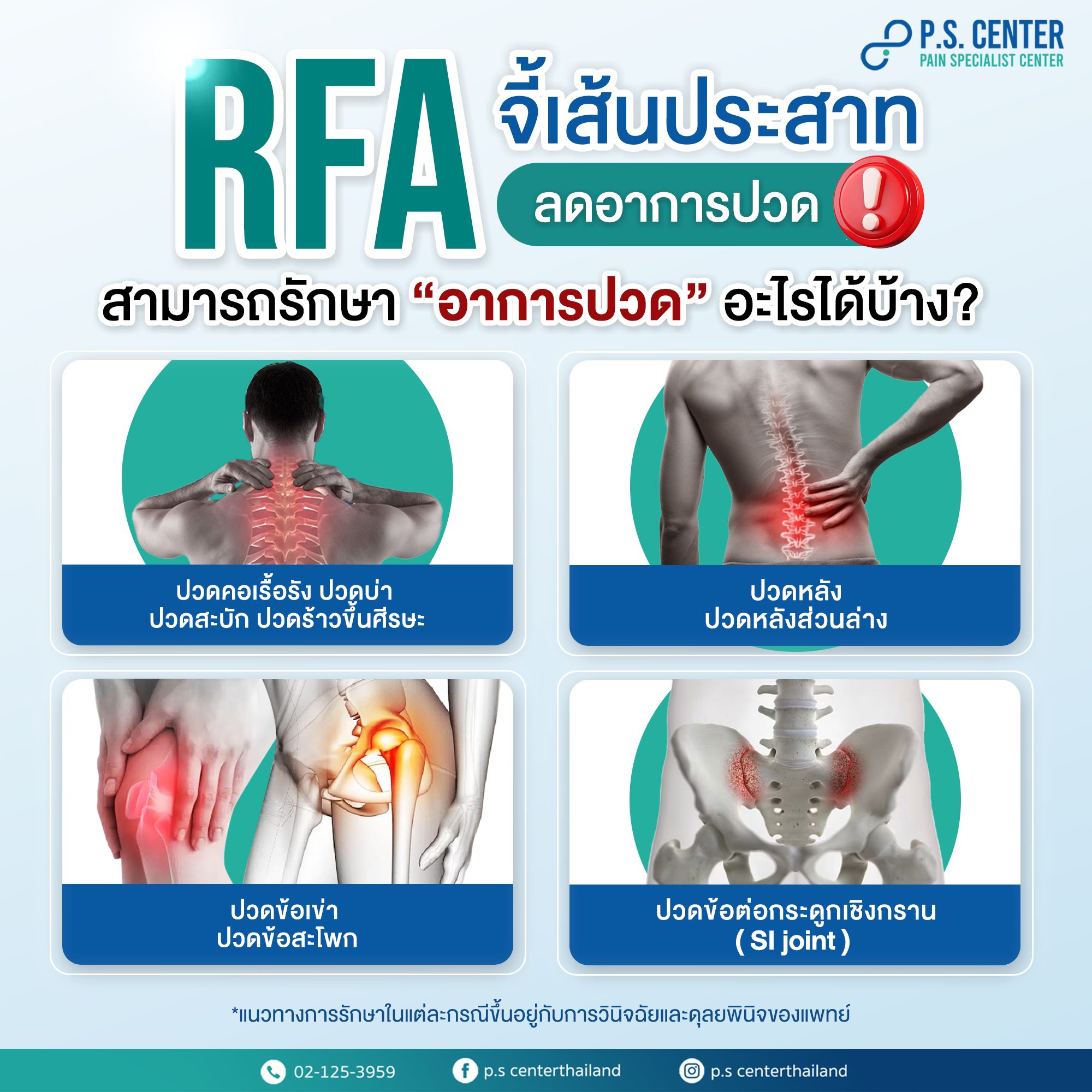 RFA จี้เส้นประสาทด้วยคลื่นวิทยุ