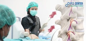 RFA จี้เส้นประสาทด้วยคลื่นวิทยุ