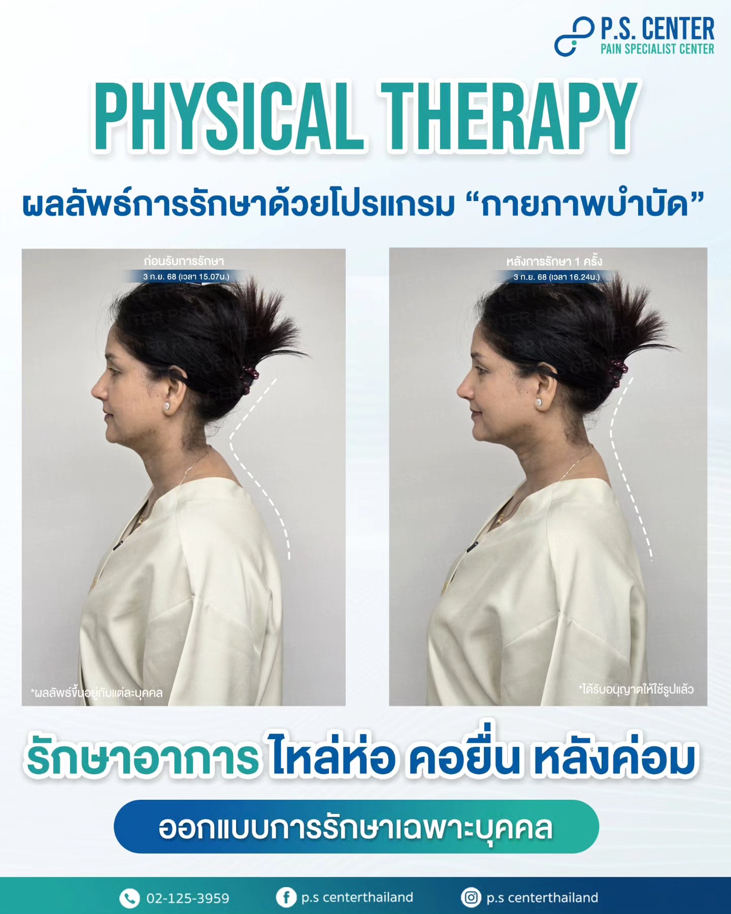 ปรับโครงสร้างร่างกาย บุคลิกภาพ