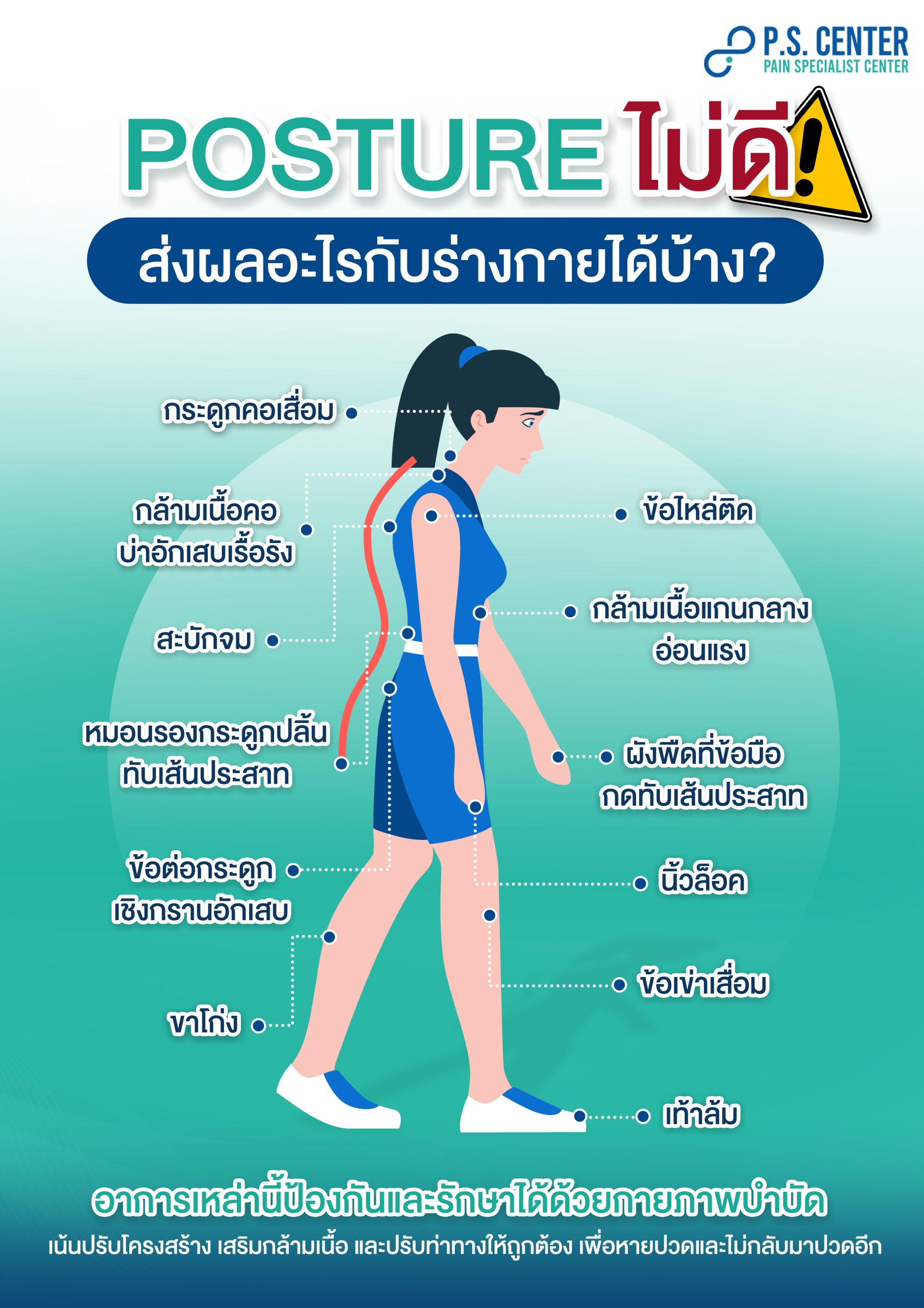 Posture ที่ไม่ดี