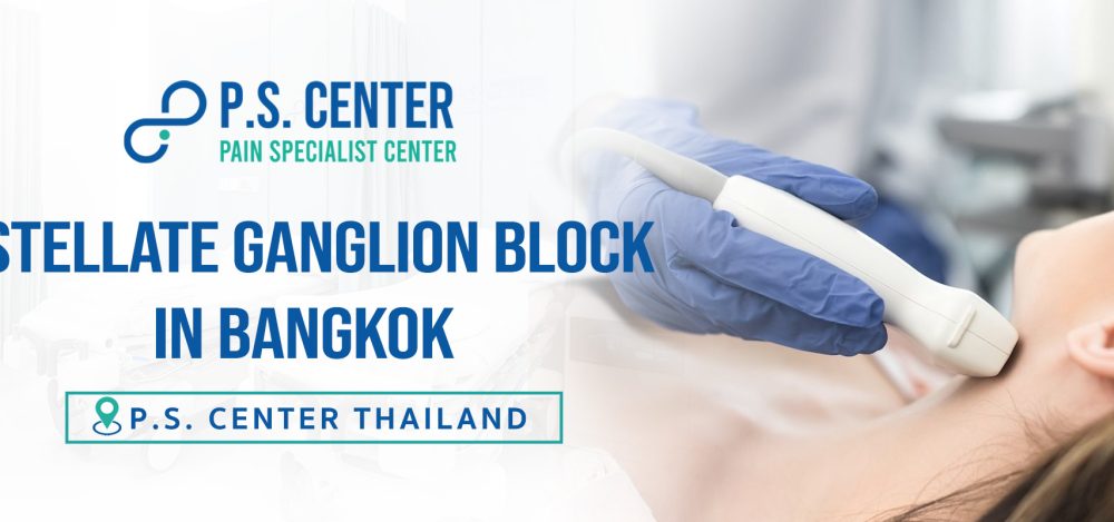 #StellateGanglionBlock